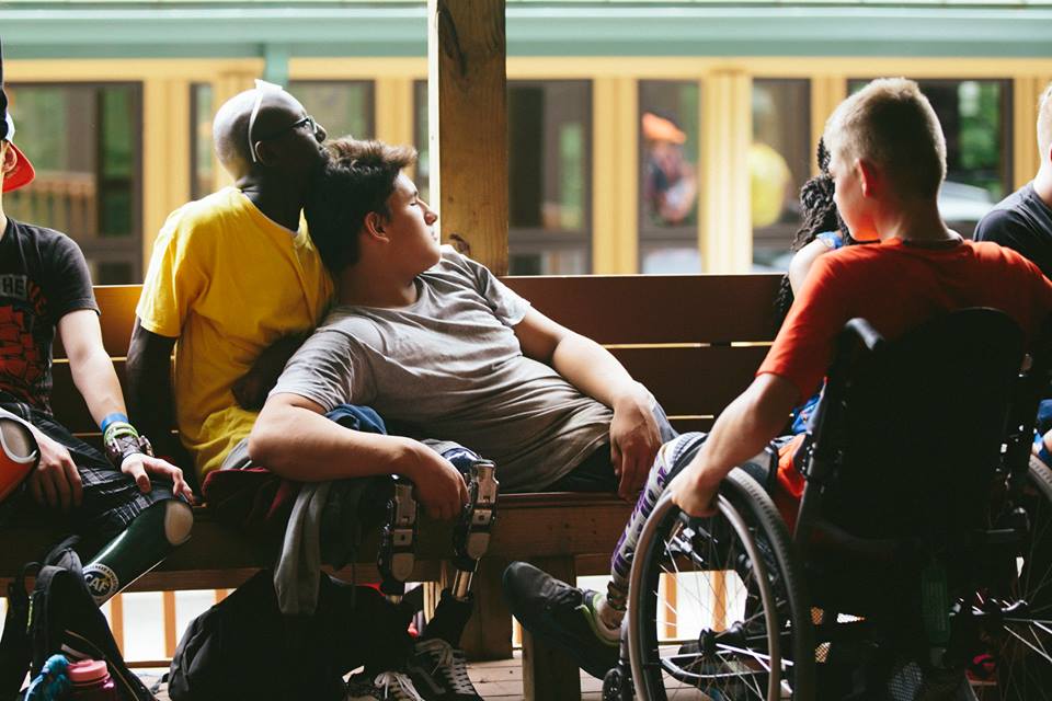 10 Reasons why Being an Amputee is the&nbsp;Best